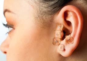 auriculoterapia
